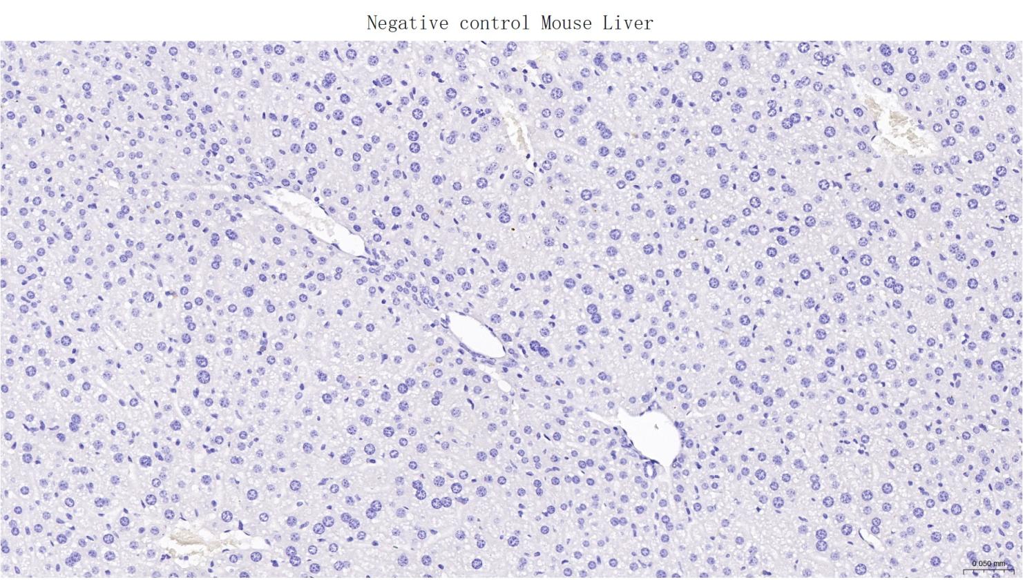 肌红蛋白重组兔单抗