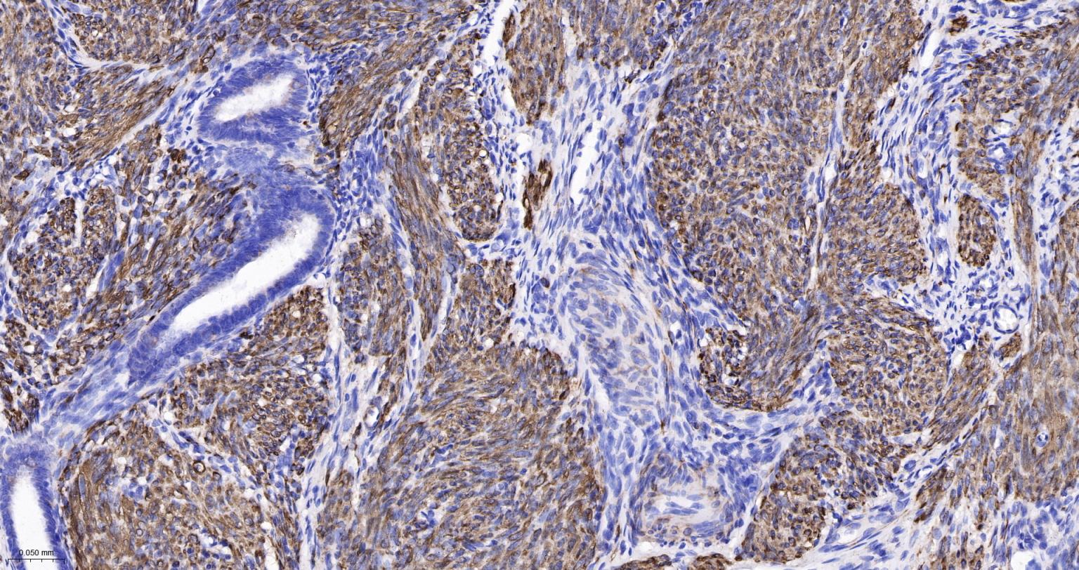 结蛋白重组兔单抗