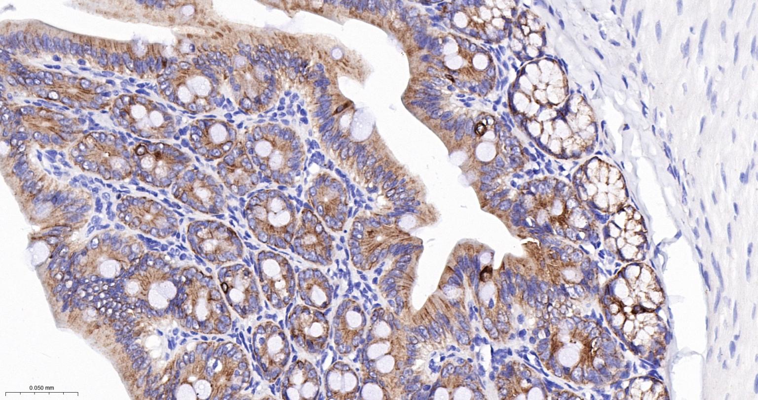 上皮钙粘附分子抗体-bsm-51351M