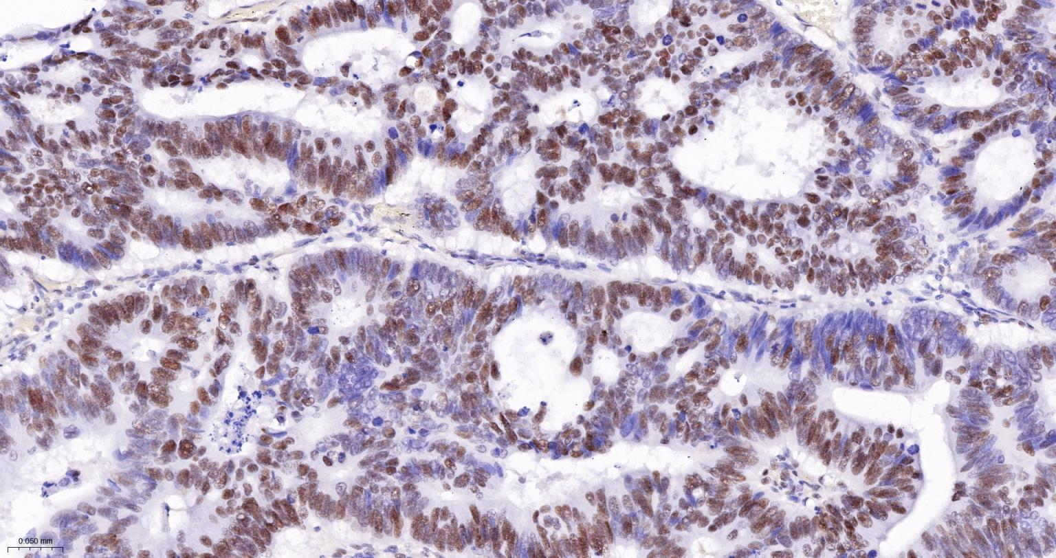 错配修复蛋白6重组兔单抗