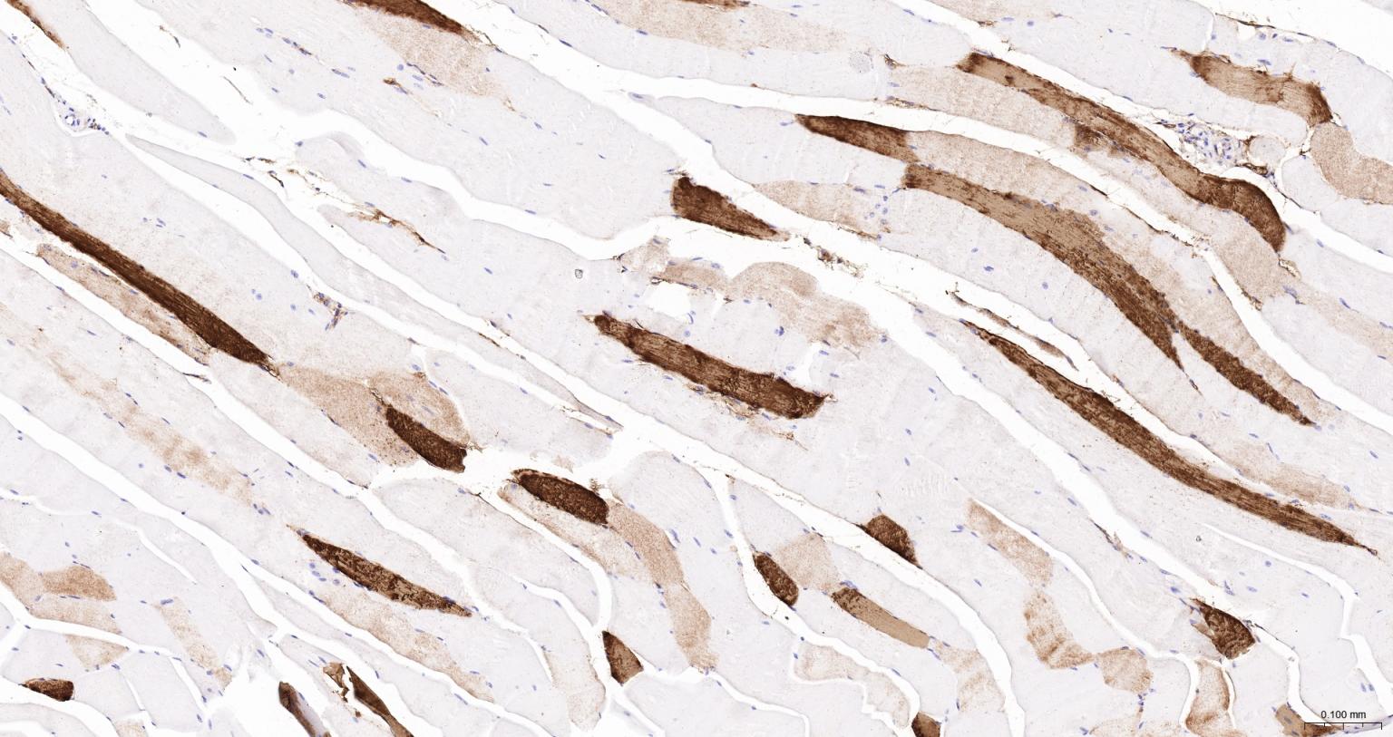 肌红蛋白重组兔单抗