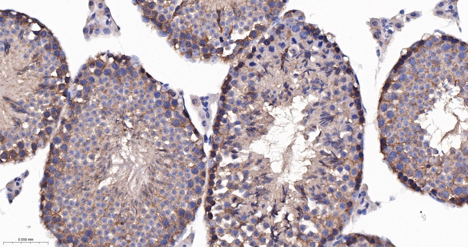 神经性舞蹈病蛋白重组兔单抗