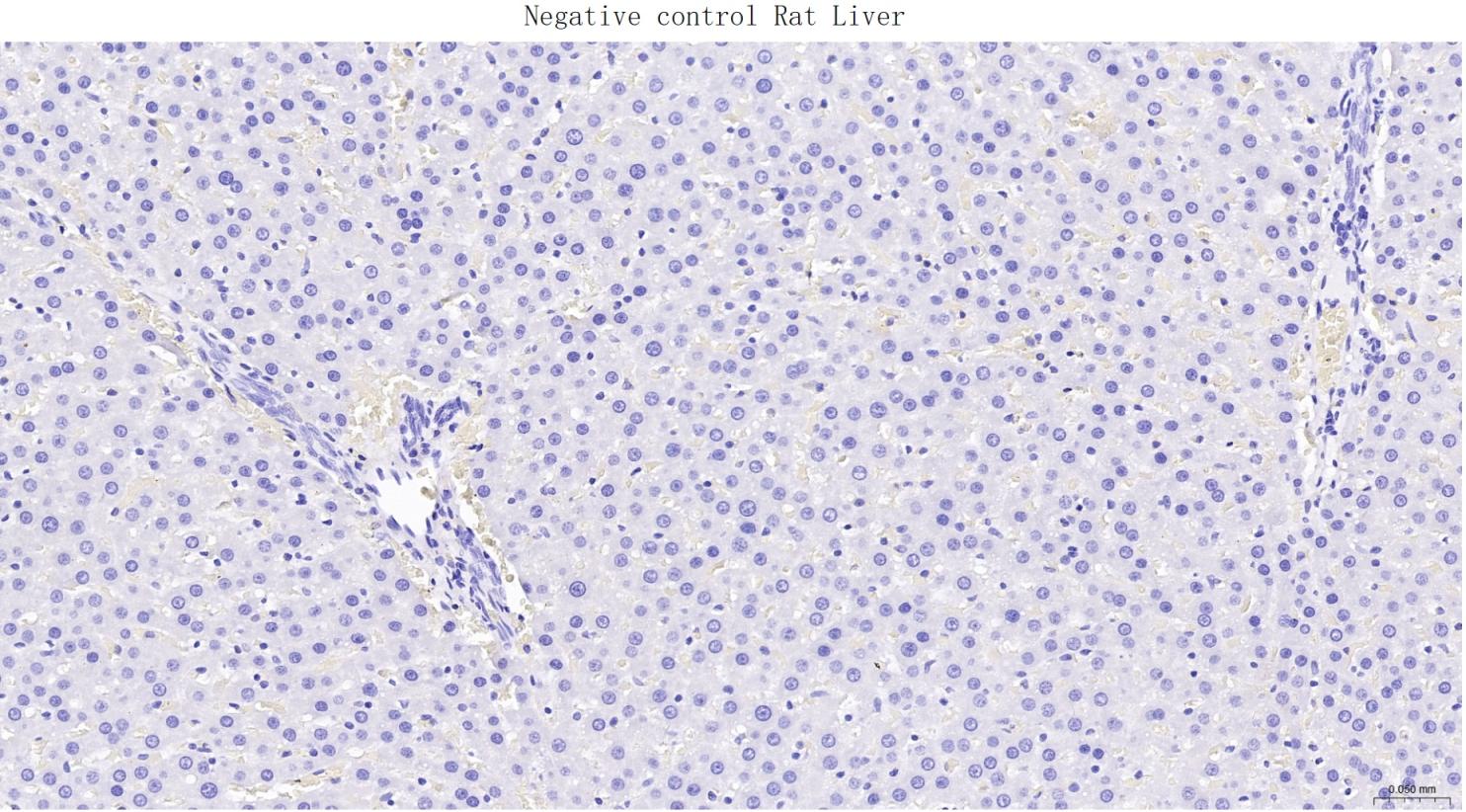 肌红蛋白重组兔单抗