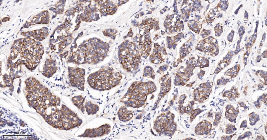 细胞角蛋白18单克隆抗体-bsm-33103M