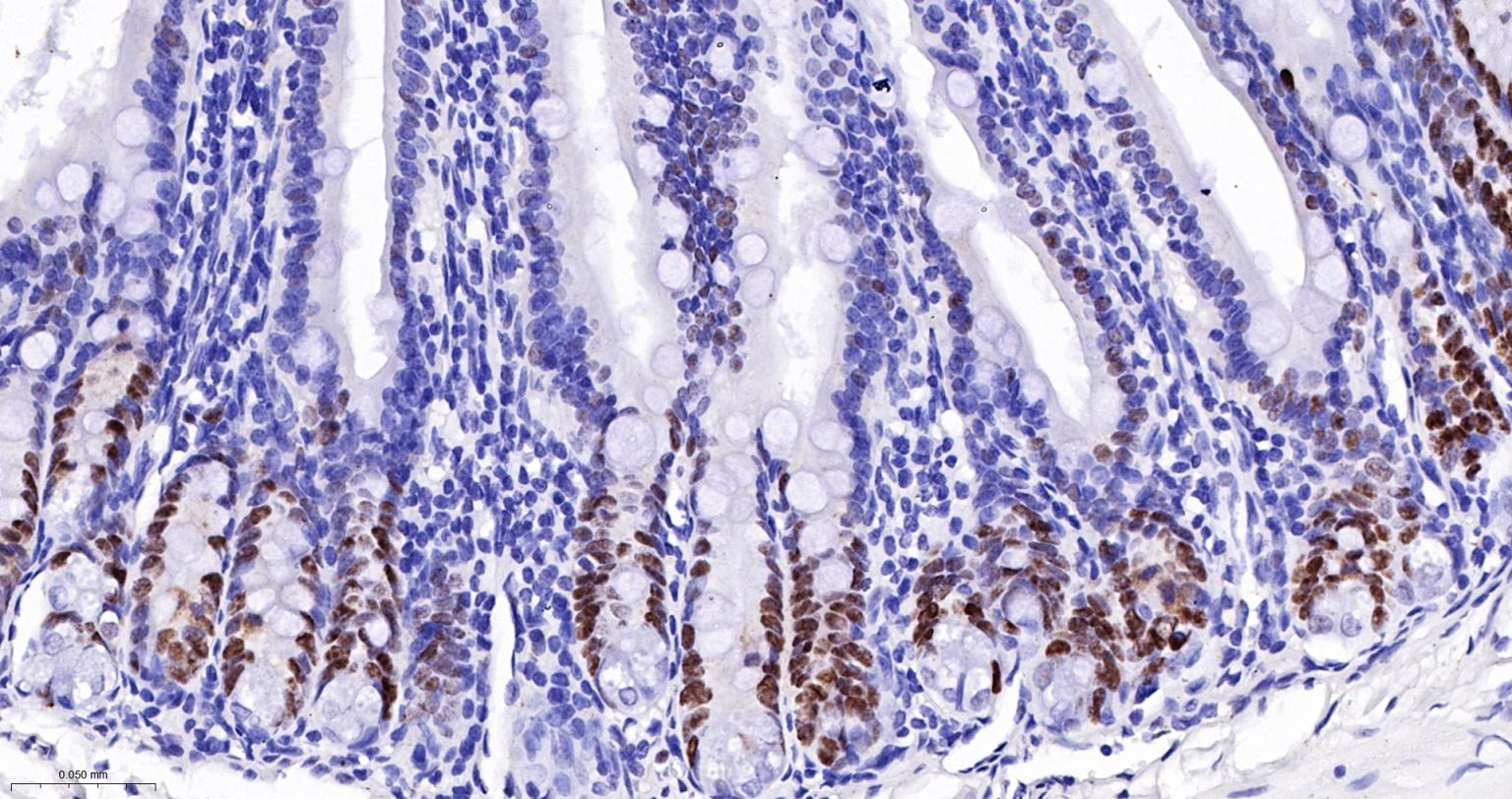 错配修复蛋白6重组兔单抗
