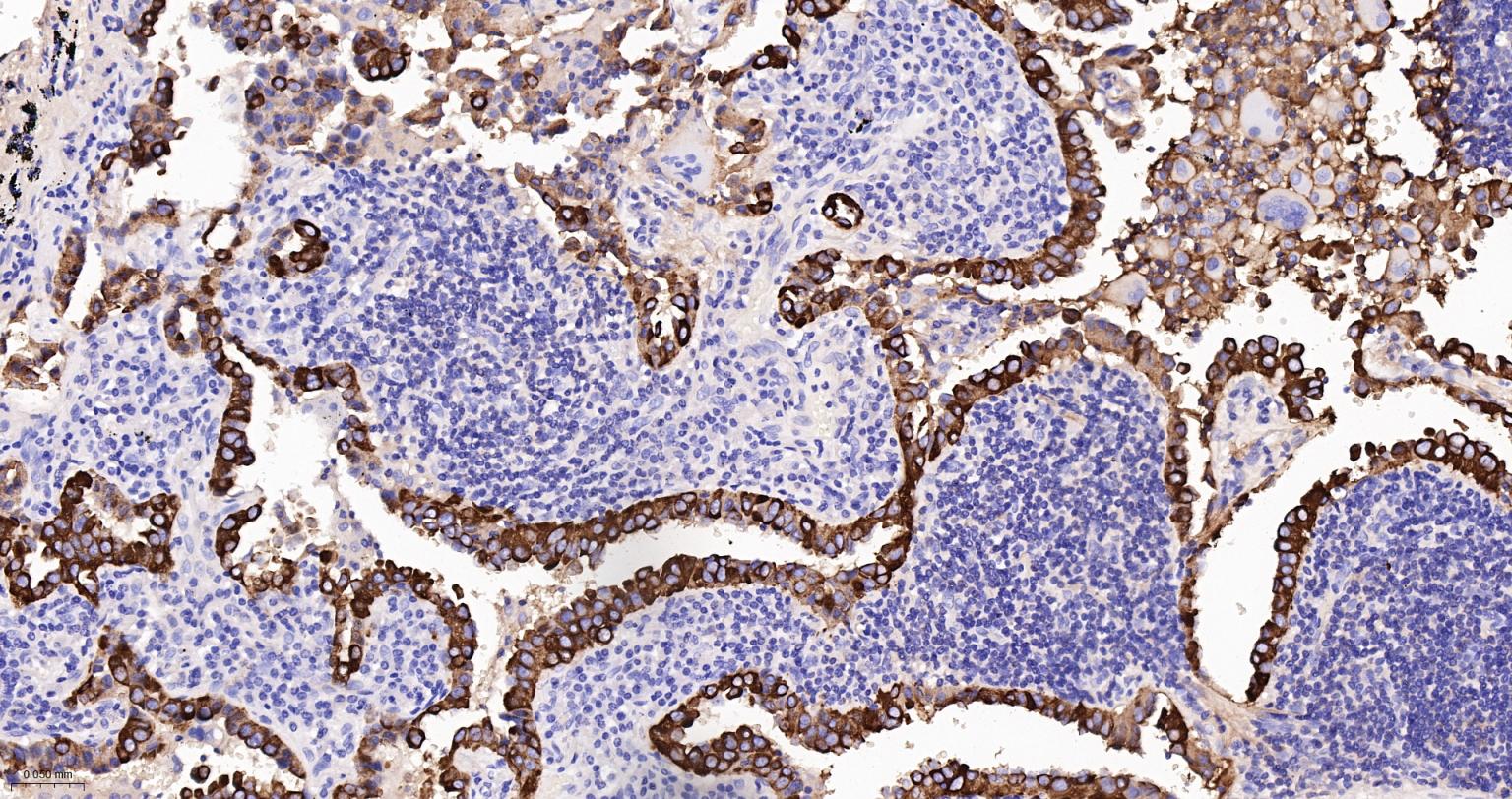 上皮钙粘附分子抗体-bsm-51351M