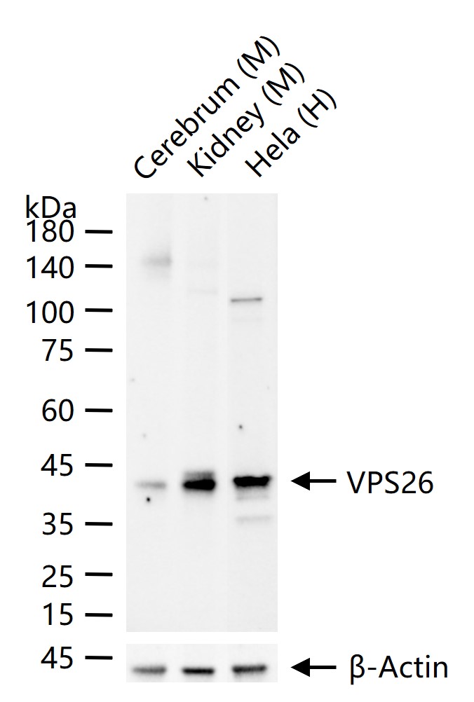 液泡蛋白分选蛋白26重组兔单抗