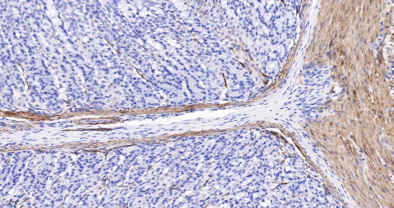 结蛋白重组兔单抗