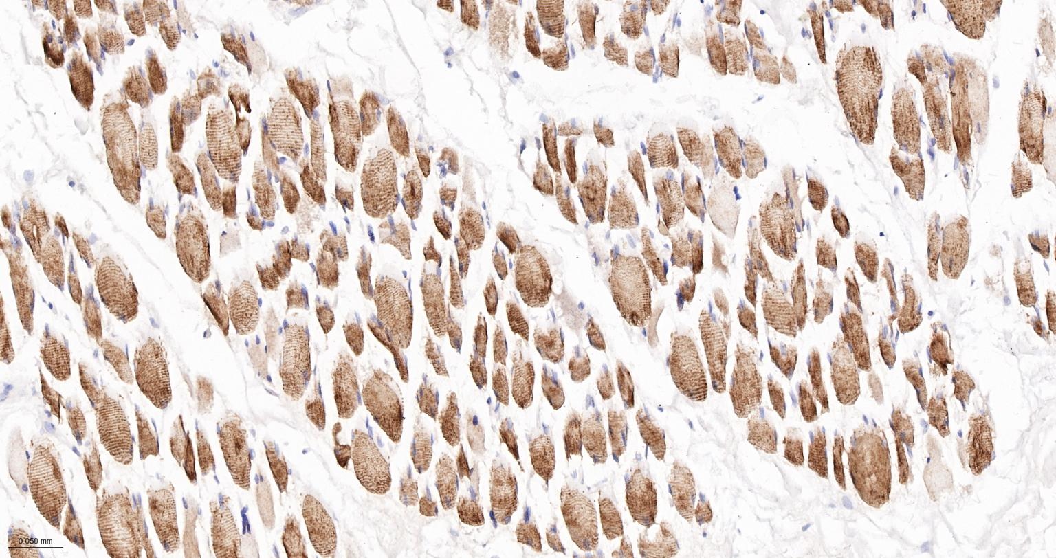 结蛋白重组兔单抗