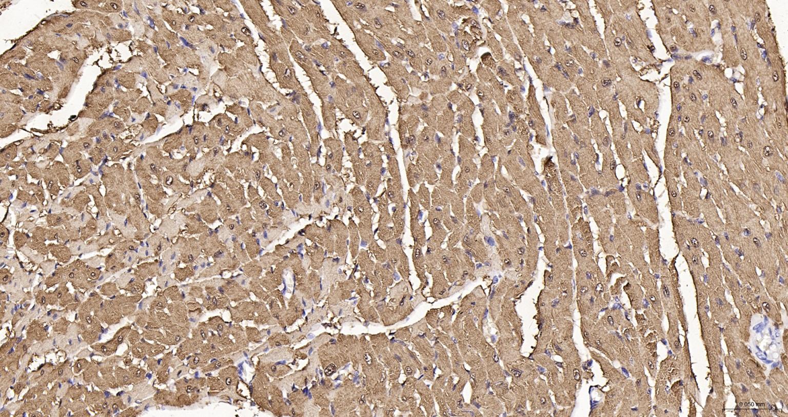 肌红蛋白重组兔单抗