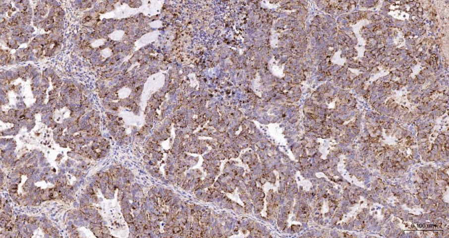 溶酶体相关膜蛋白1（CD107）重组兔单抗