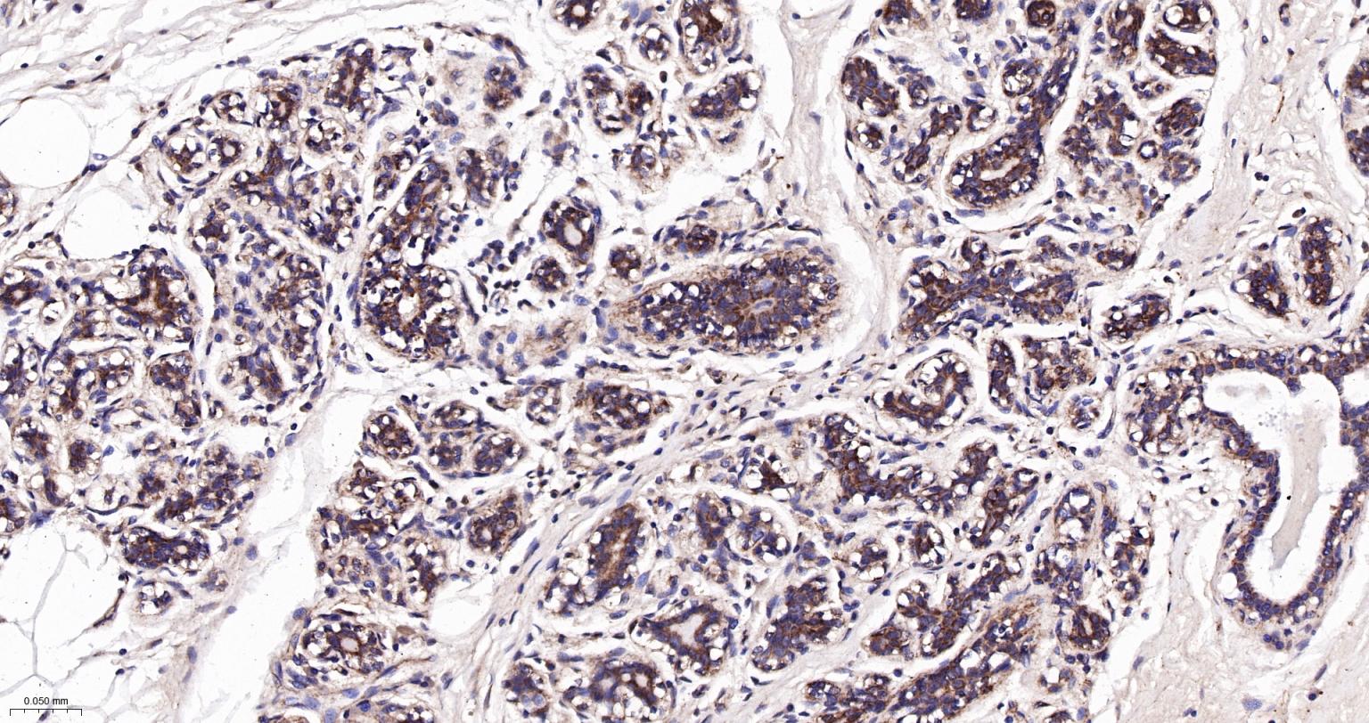 己糖激酶1重组兔单抗