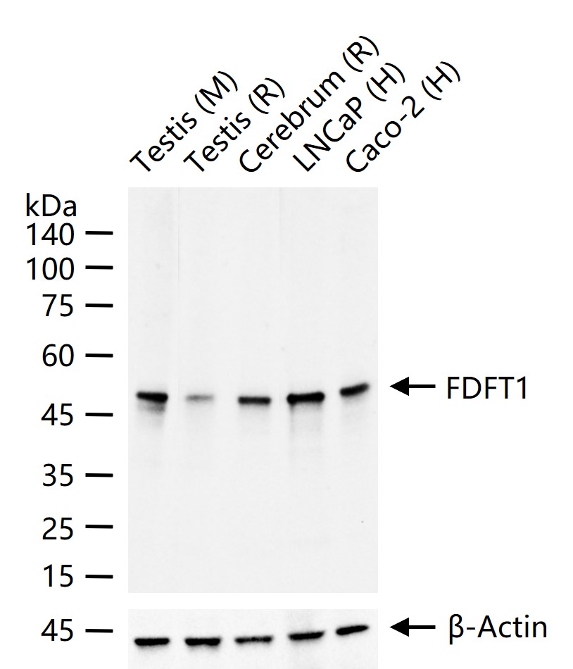 法尼基二磷酸法尼基转移酶1/鲨烯合成酶重组兔单抗-bsm-61816R