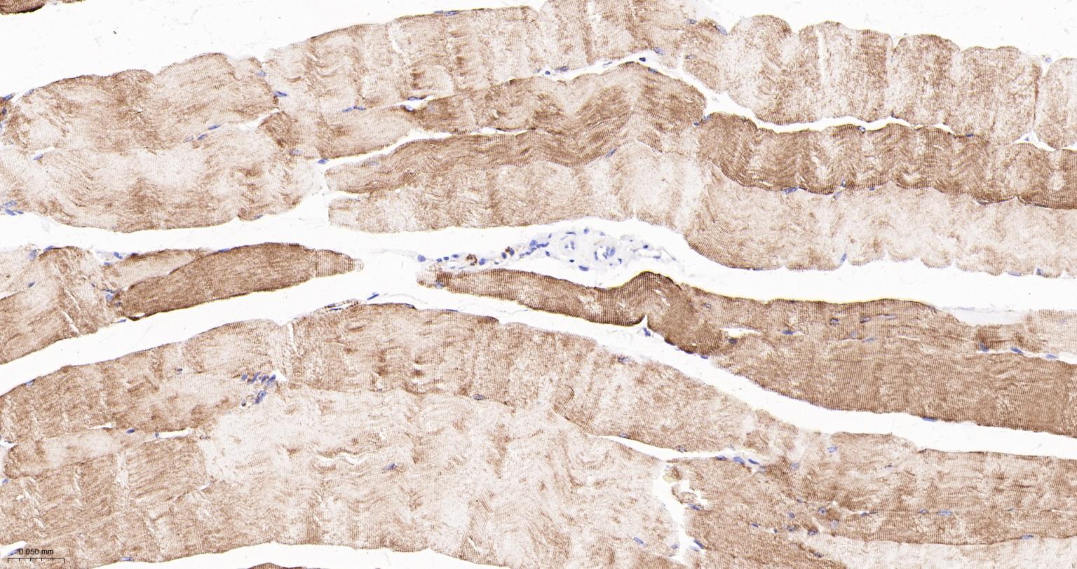 结蛋白重组兔单抗
