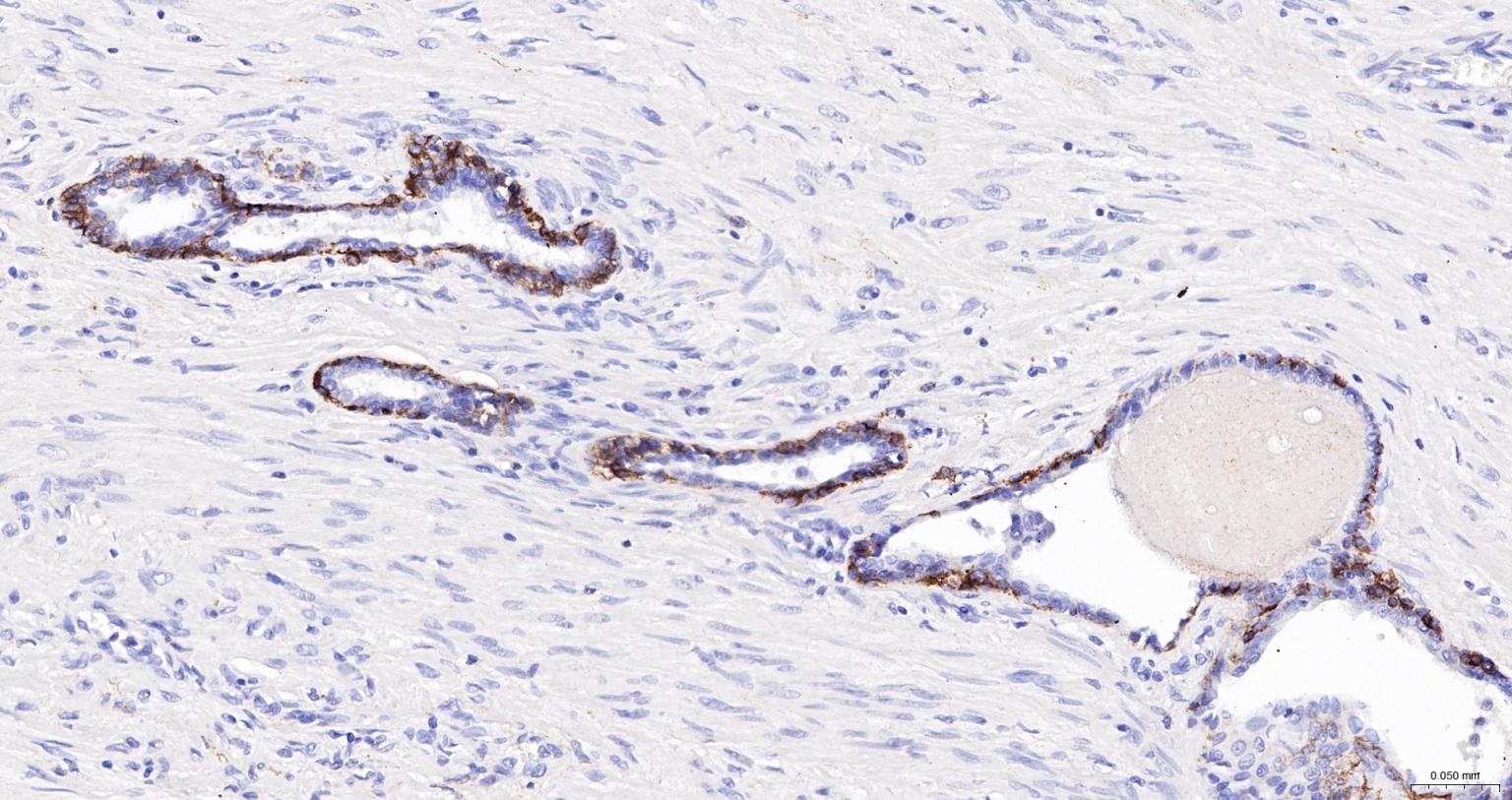 神经生长因子受体重组兔单抗