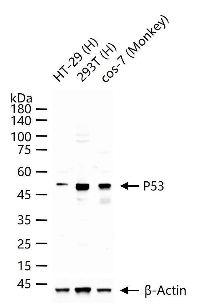 细胞肿瘤抗原P53抗体-bs-8687R