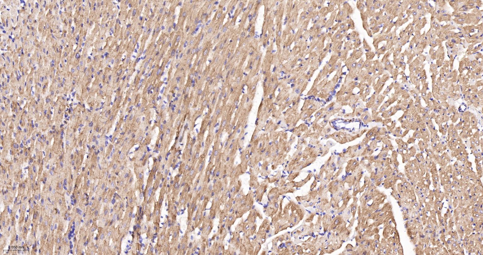 结蛋白重组兔单抗