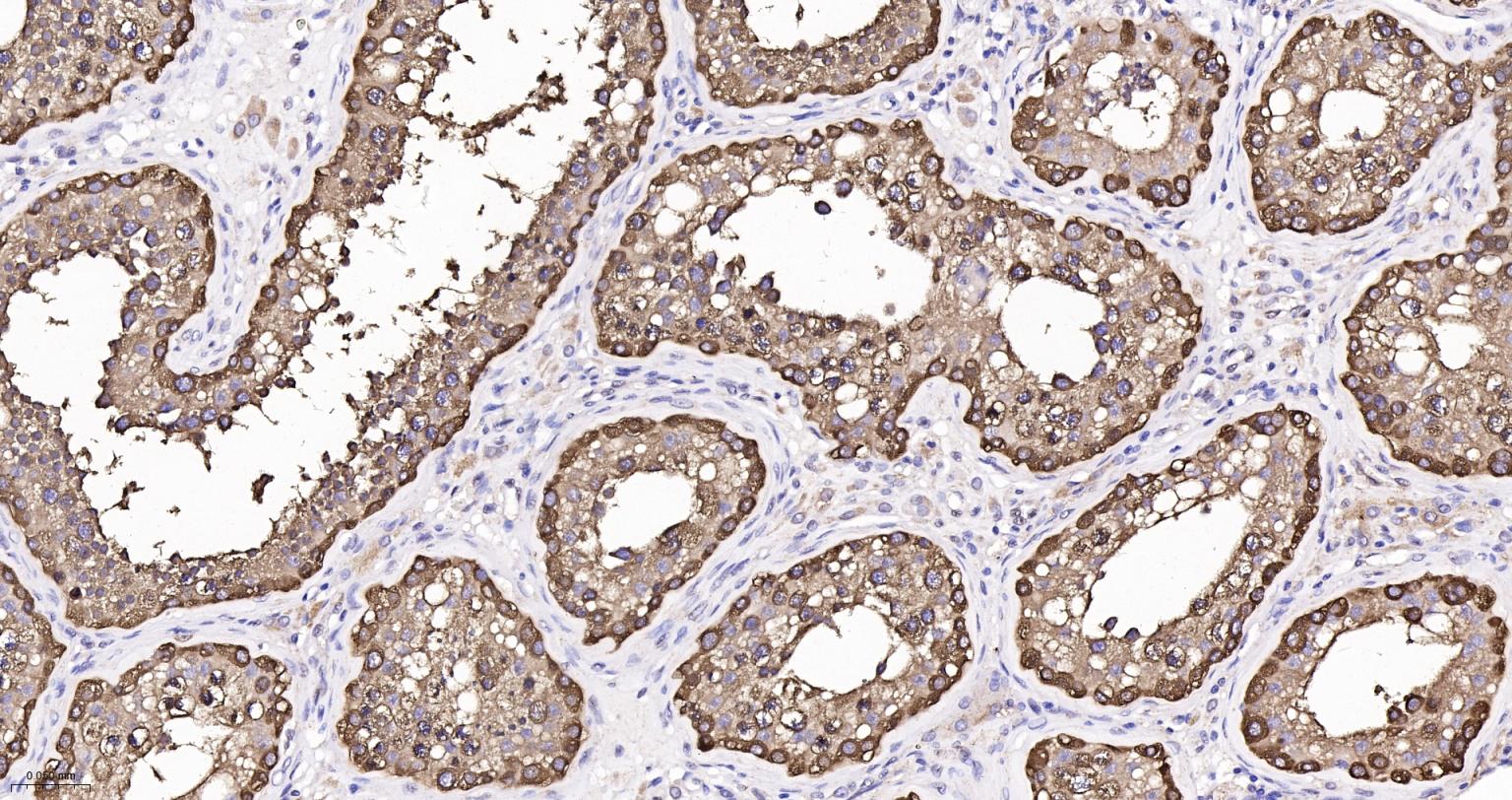 热休克蛋白90β/HSP90 β 重组兔单抗