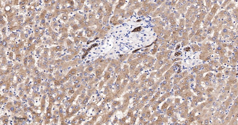细胞角蛋白18单克隆抗体-bsm-33103M
