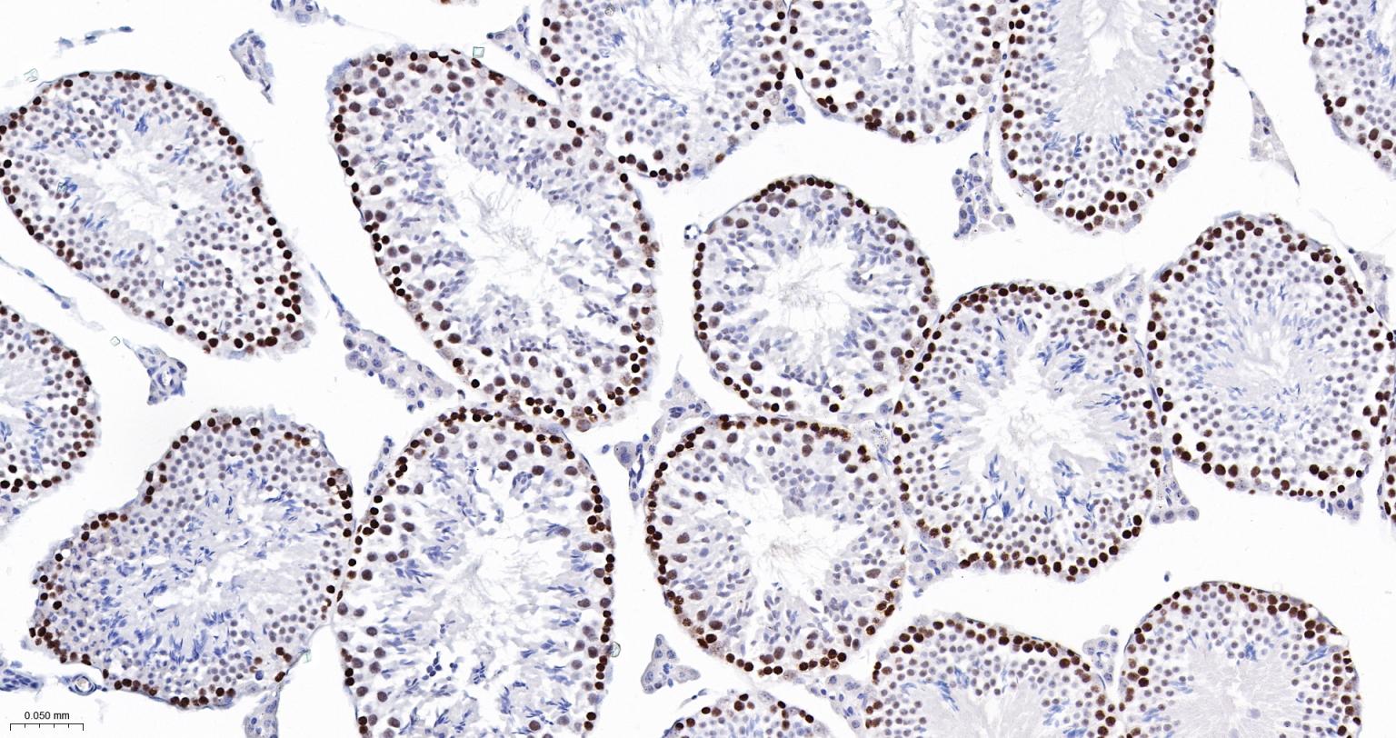 错配修复蛋白6重组兔单抗