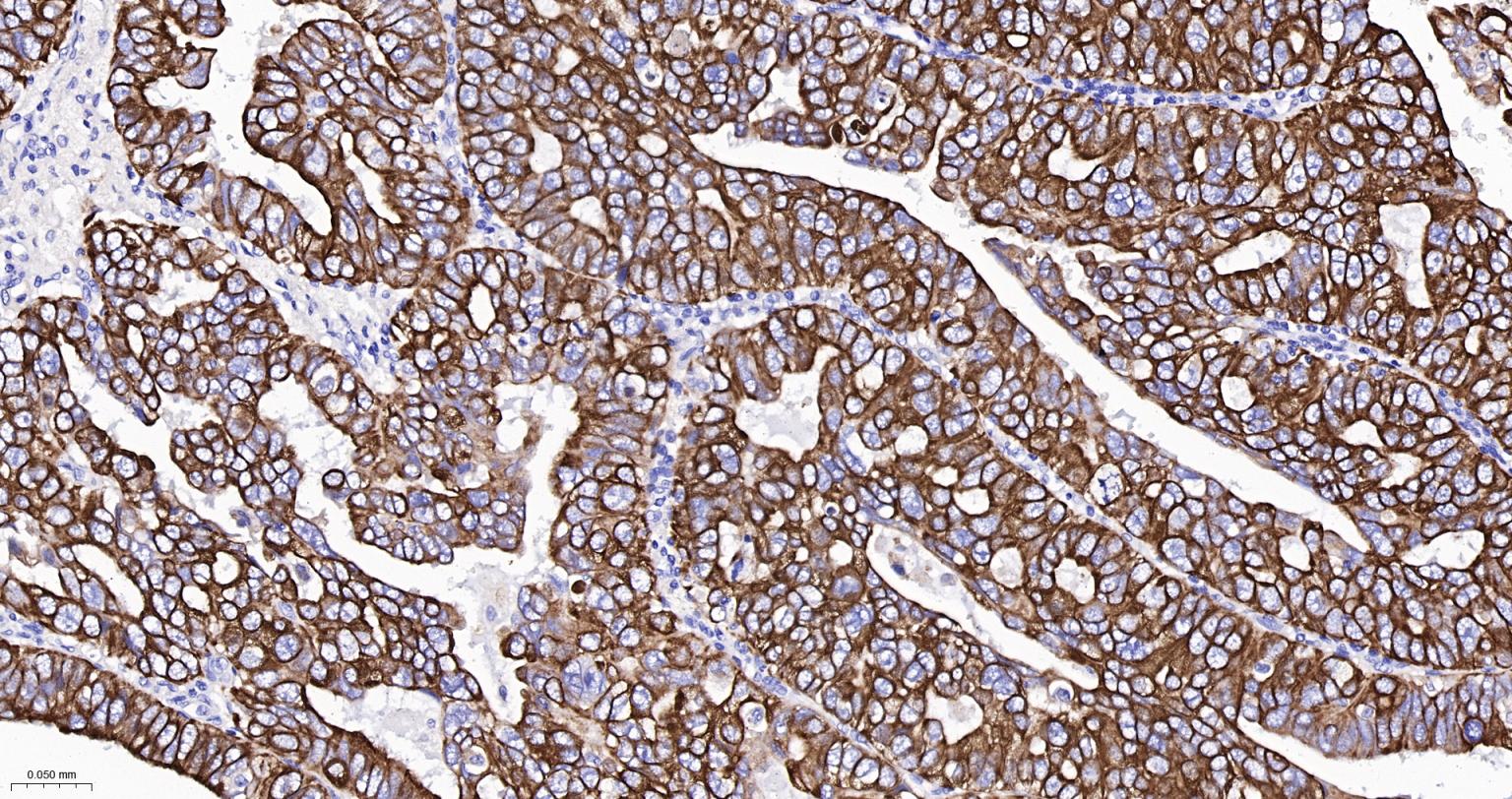E cadherin Mouse mAb (一抗) - IHC-P,IHC-F,IF | Bioss