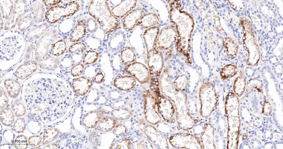 载脂蛋白D重组兔单抗