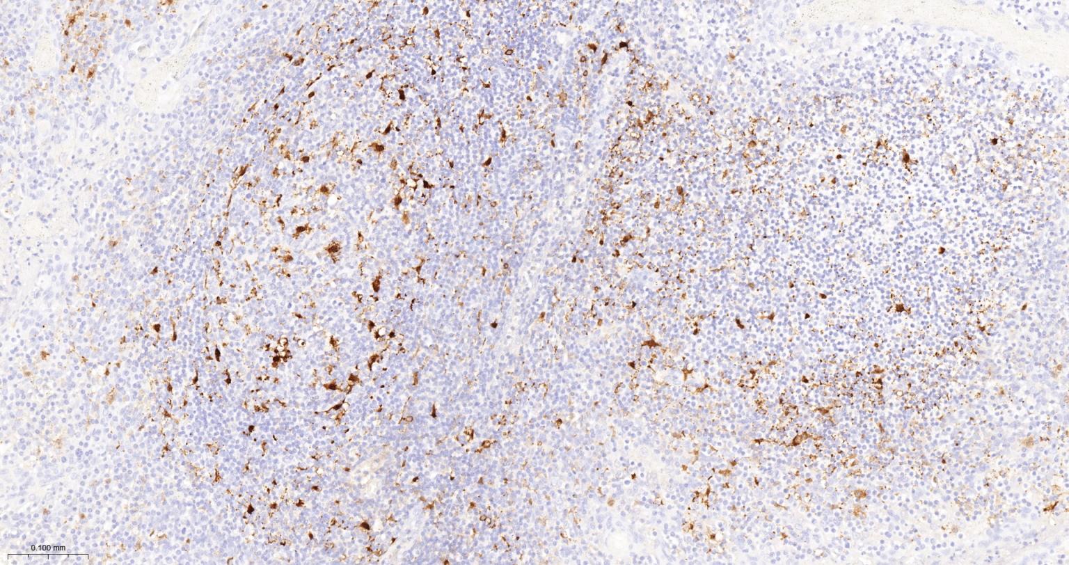 白细胞介素-18/干扰素γ诱导因子重组兔单抗