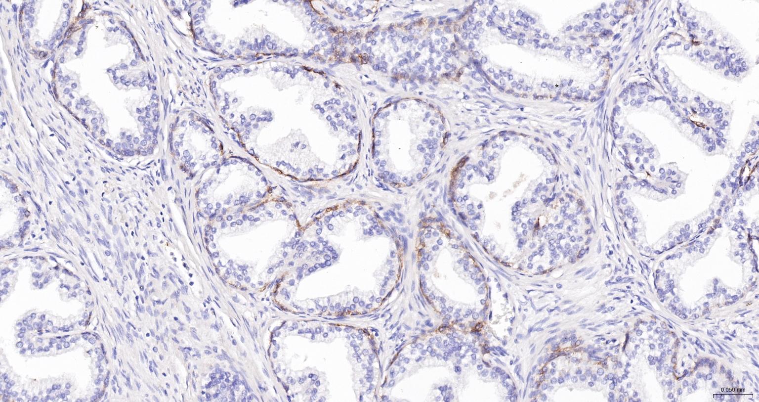 神经生长因子受体重组兔单抗