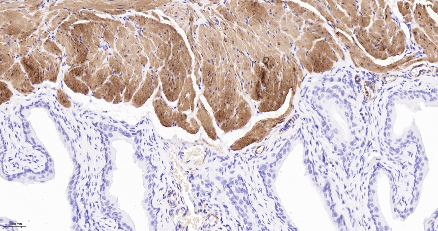结蛋白重组兔单抗