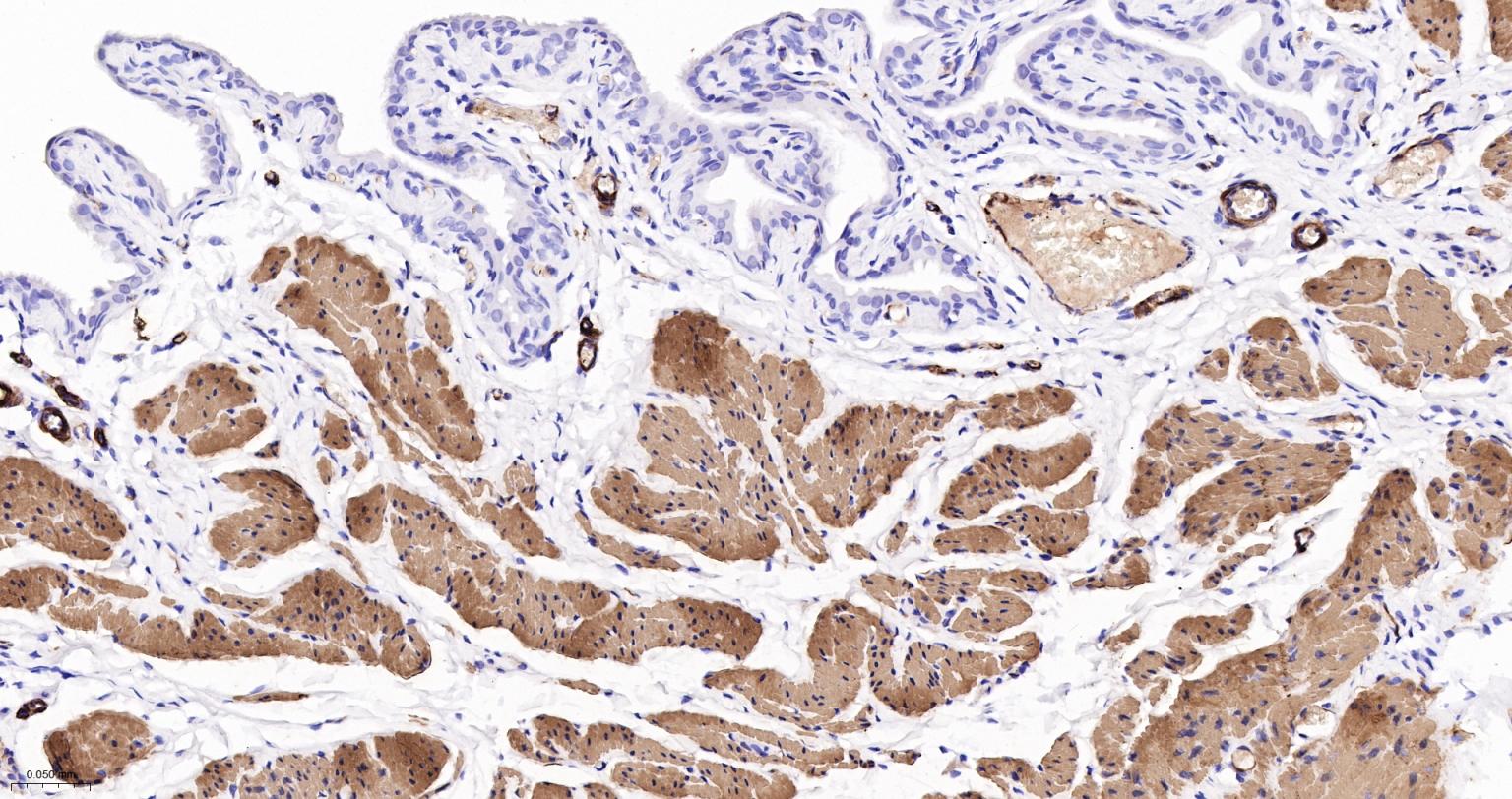 结蛋白重组兔单抗