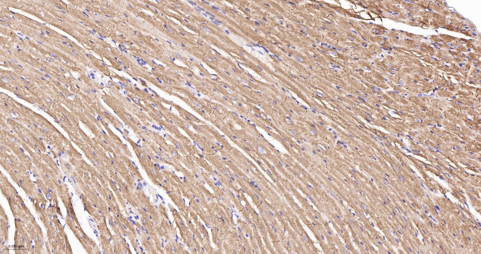 结蛋白重组兔单抗