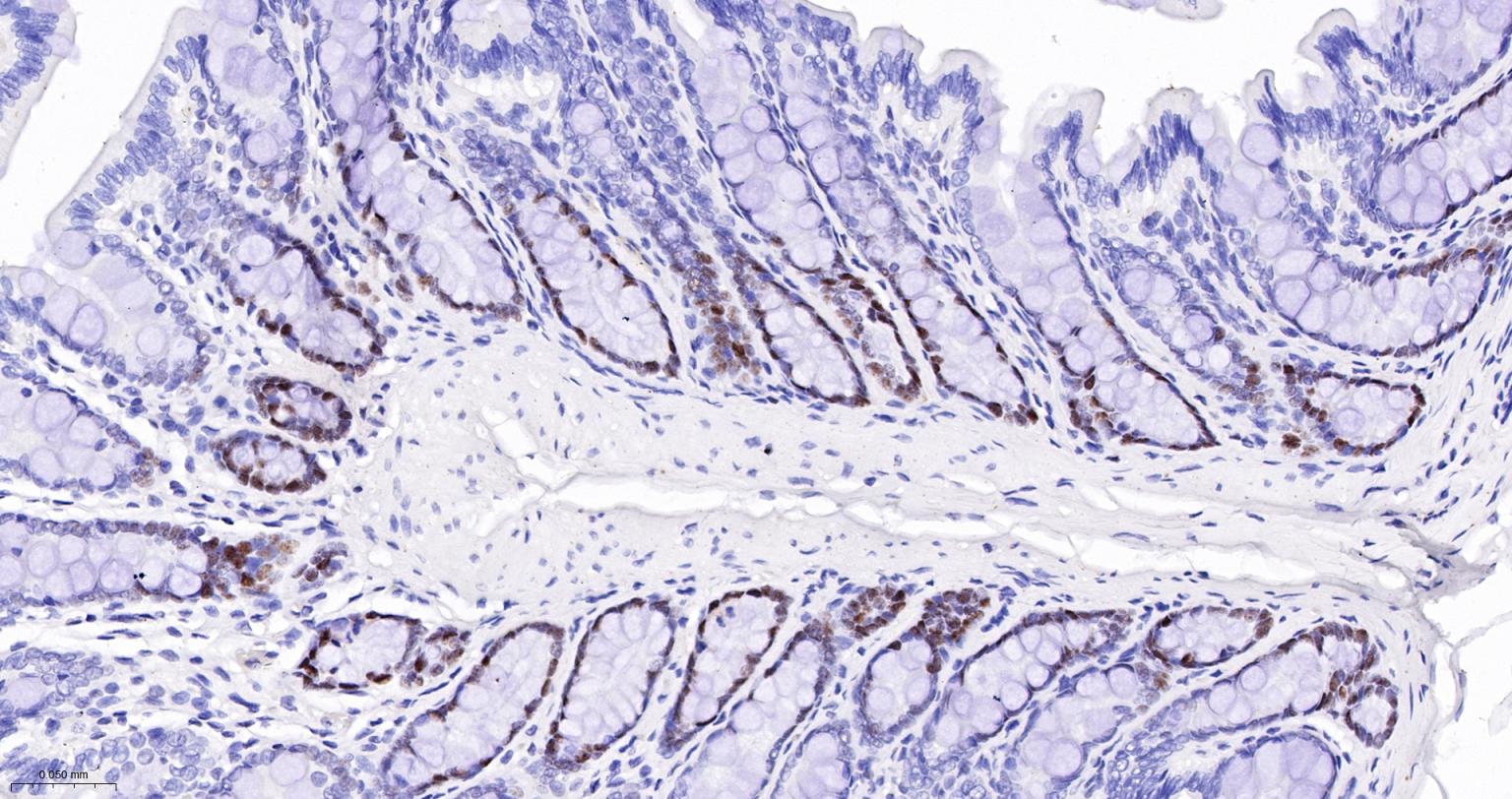 错配修复蛋白6重组兔单抗
