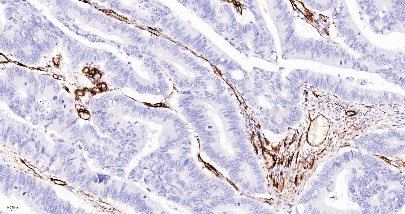 CD105抗体-bs-34063R