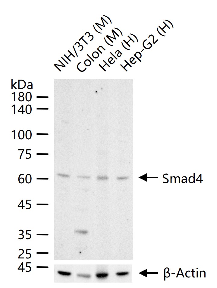 Smad4 Rabbit pAb (一抗) - WB | Bioss