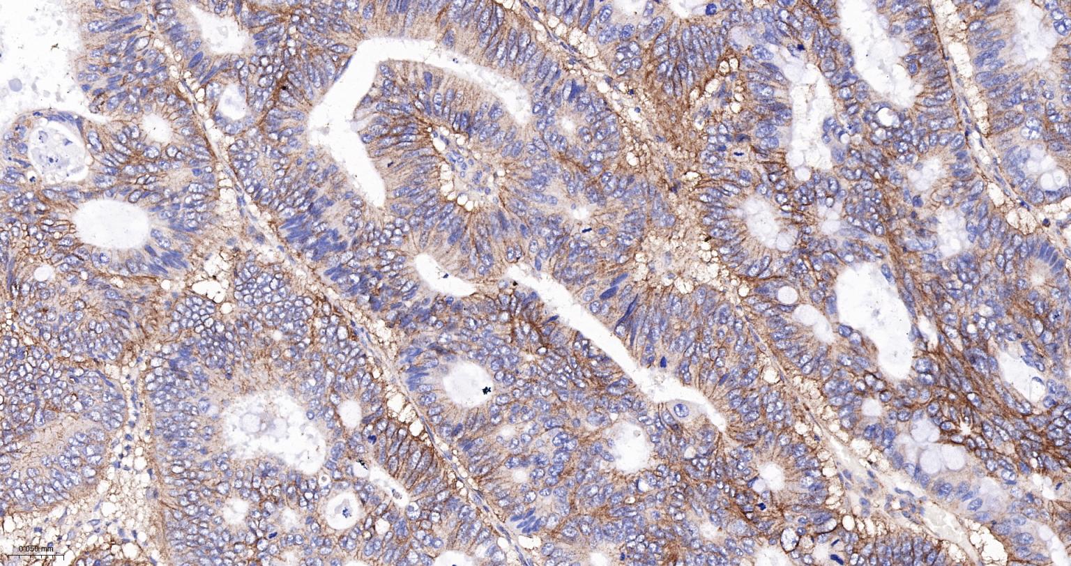 CD99重组兔单克隆抗体
