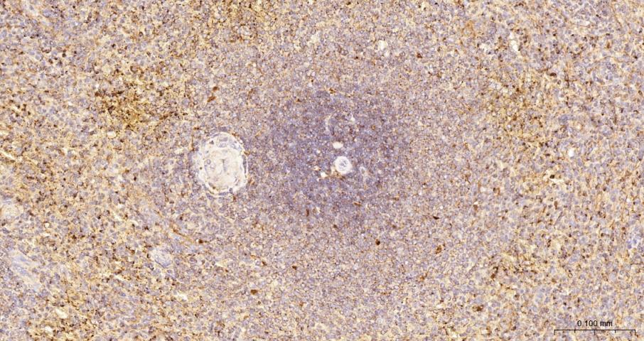 溶酶体相关膜蛋白1（CD107）重组兔单抗