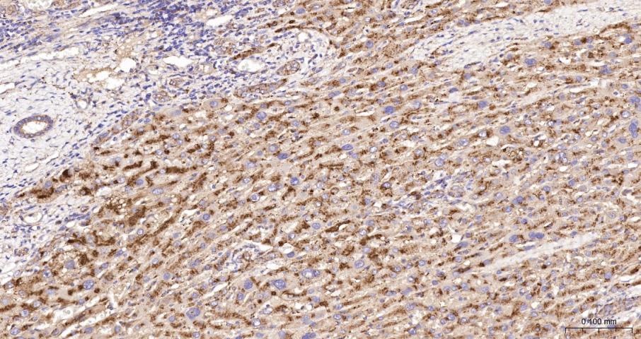 溶酶体相关膜蛋白1（CD107）重组兔单抗