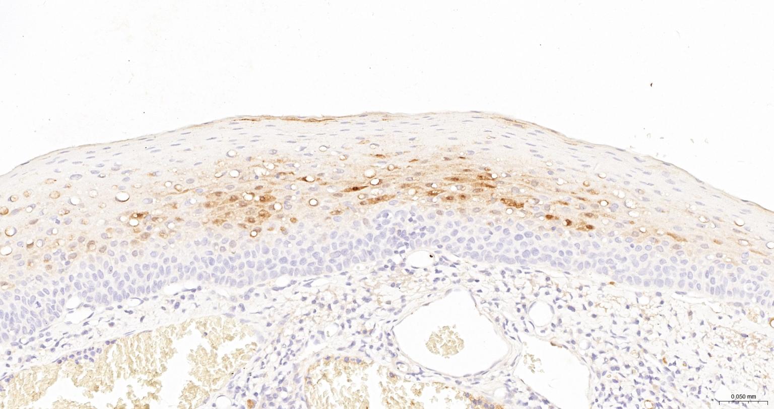 丝氨酸蛋白酶抑制剂B3重组兔单抗