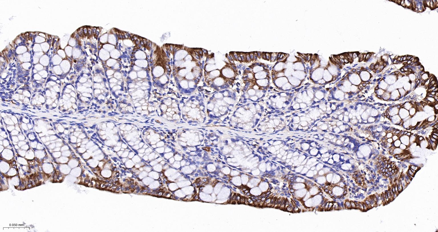 上皮钙粘附分子抗体-bsm-51351M