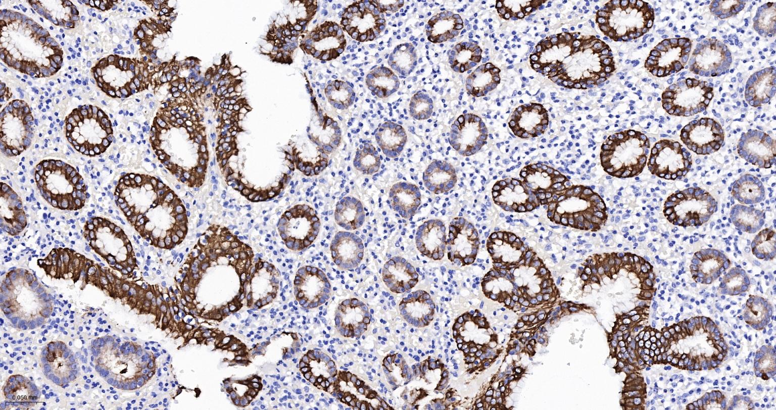 上皮钙粘附分子抗体-bsm-51351M