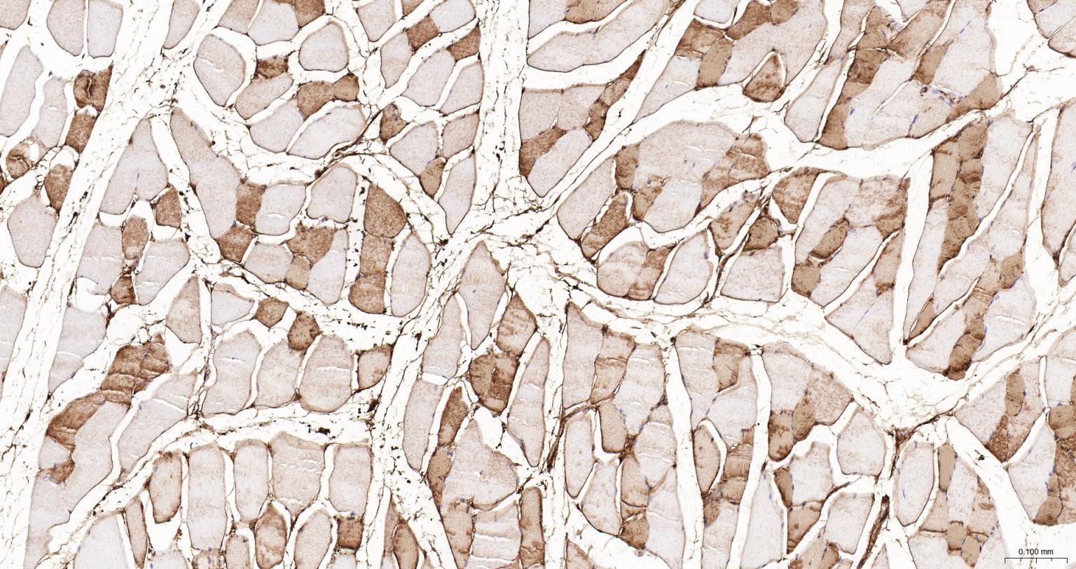 肌红蛋白重组兔单抗