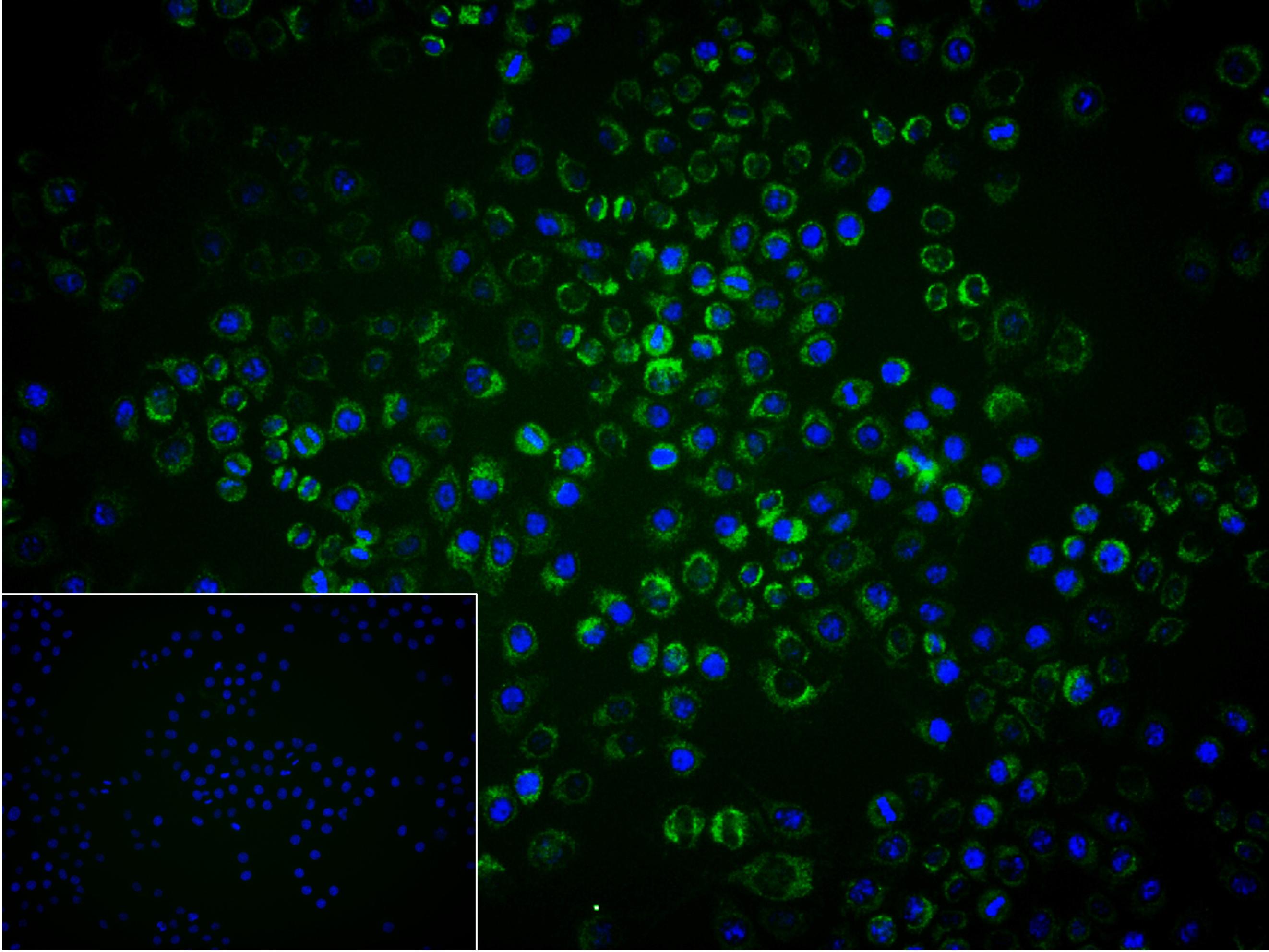 硫辛酰胺脱氢酶重组兔单抗