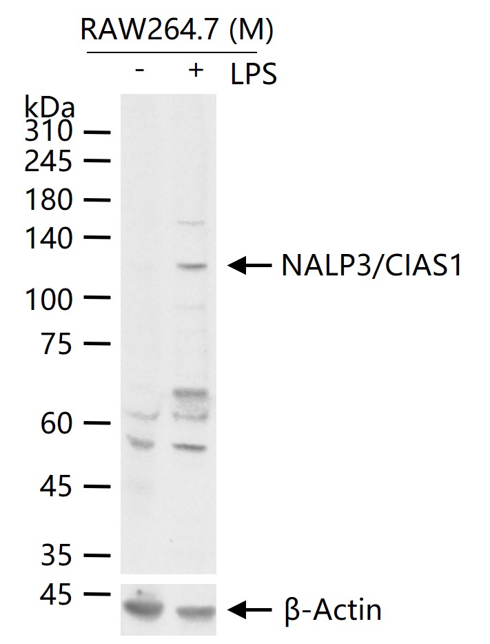 NALP3/CIAS1 Rabbit pAb (一抗) - WB | Bioss