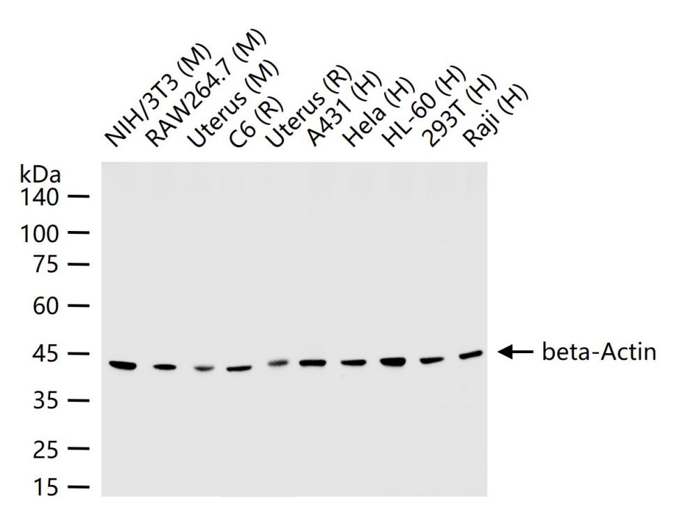 β-肌动蛋白/β-Actin(内参)抗体