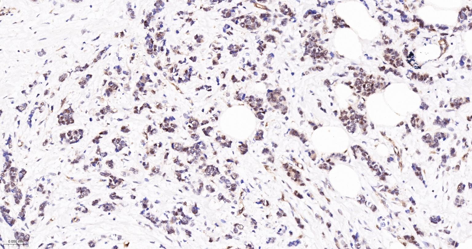 肿瘤错配修复基因PMS2重组兔单抗