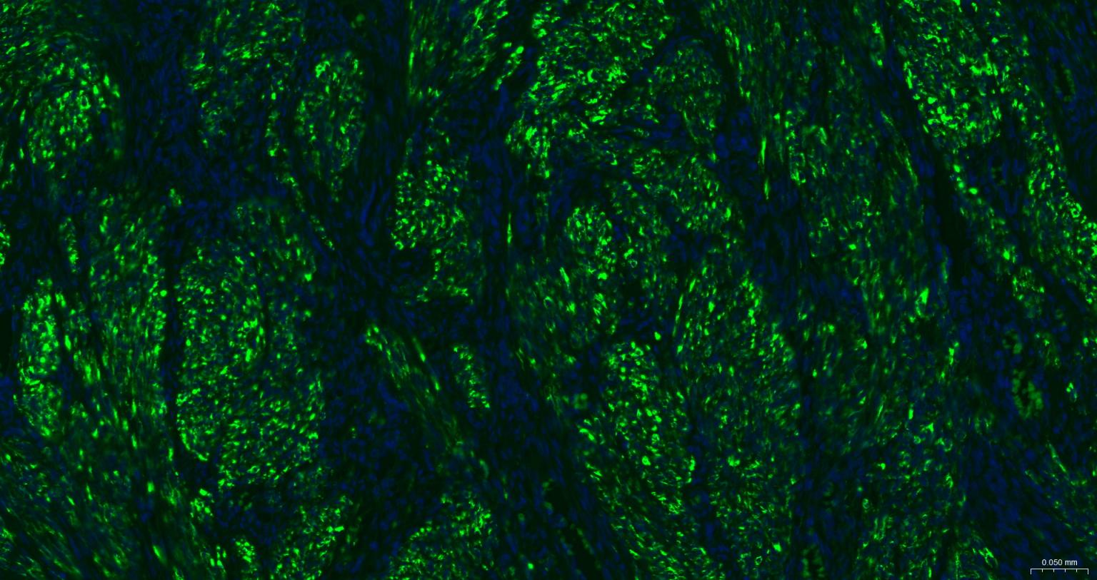 结蛋白重组兔单抗