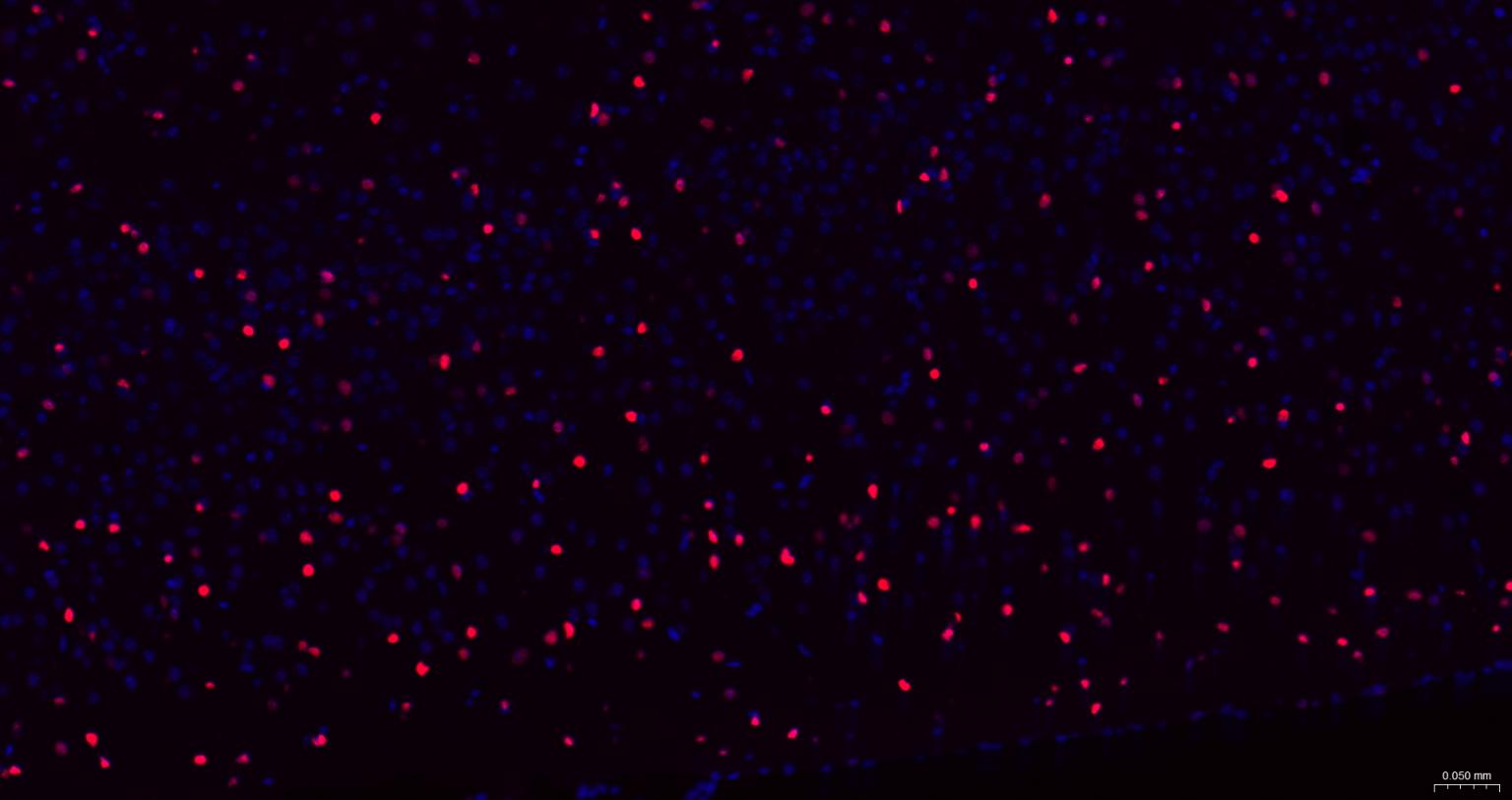 胚胎干细胞关键蛋白重组兔单克隆抗体