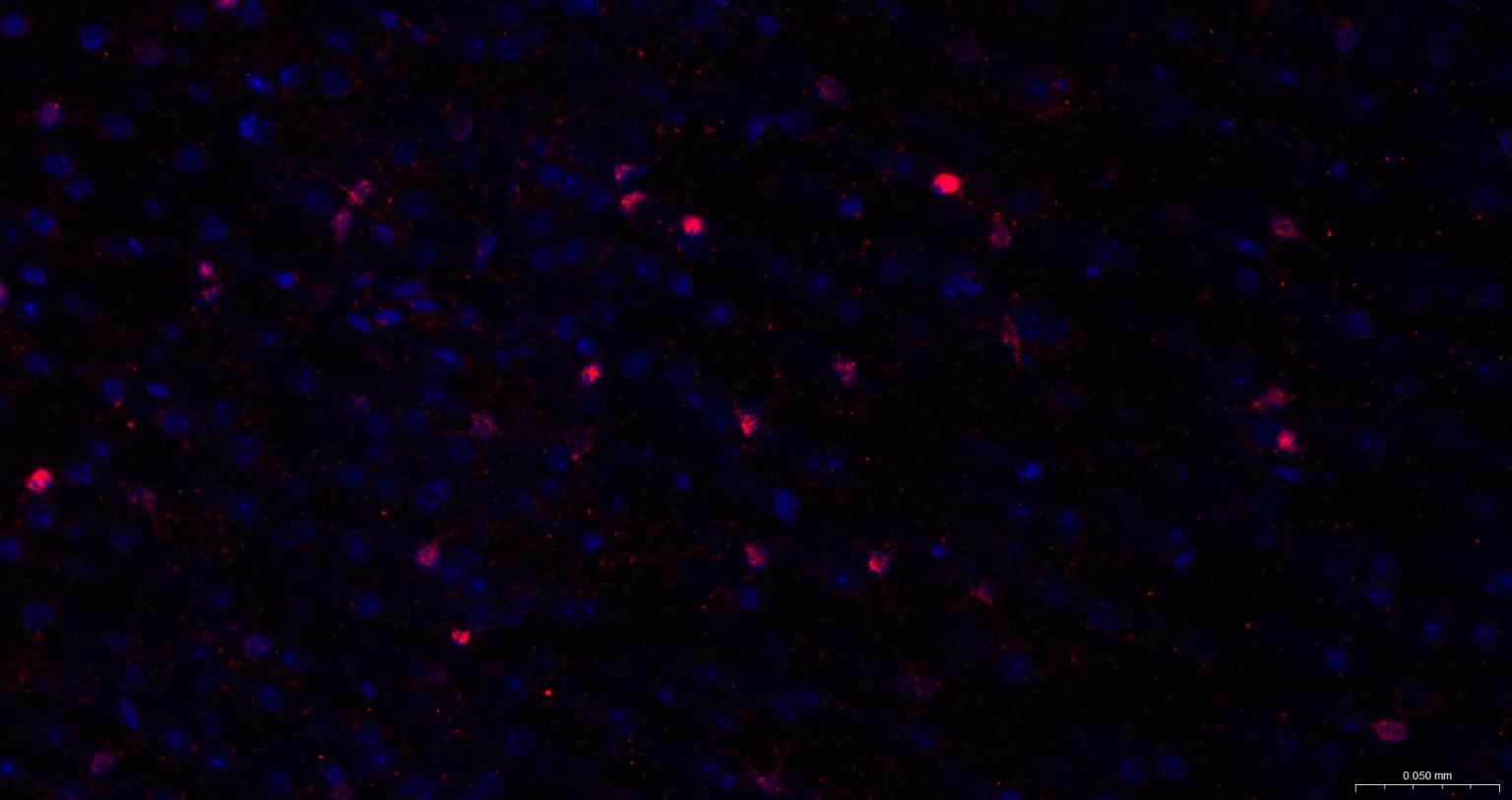 人S100A1多克隆抗体-bs-41209R