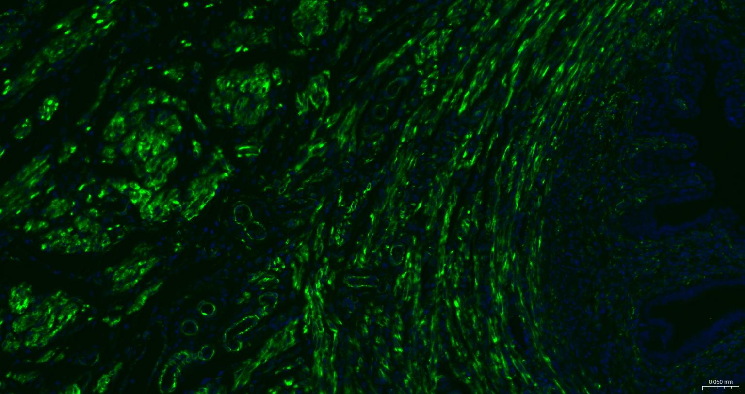 结蛋白重组兔单抗