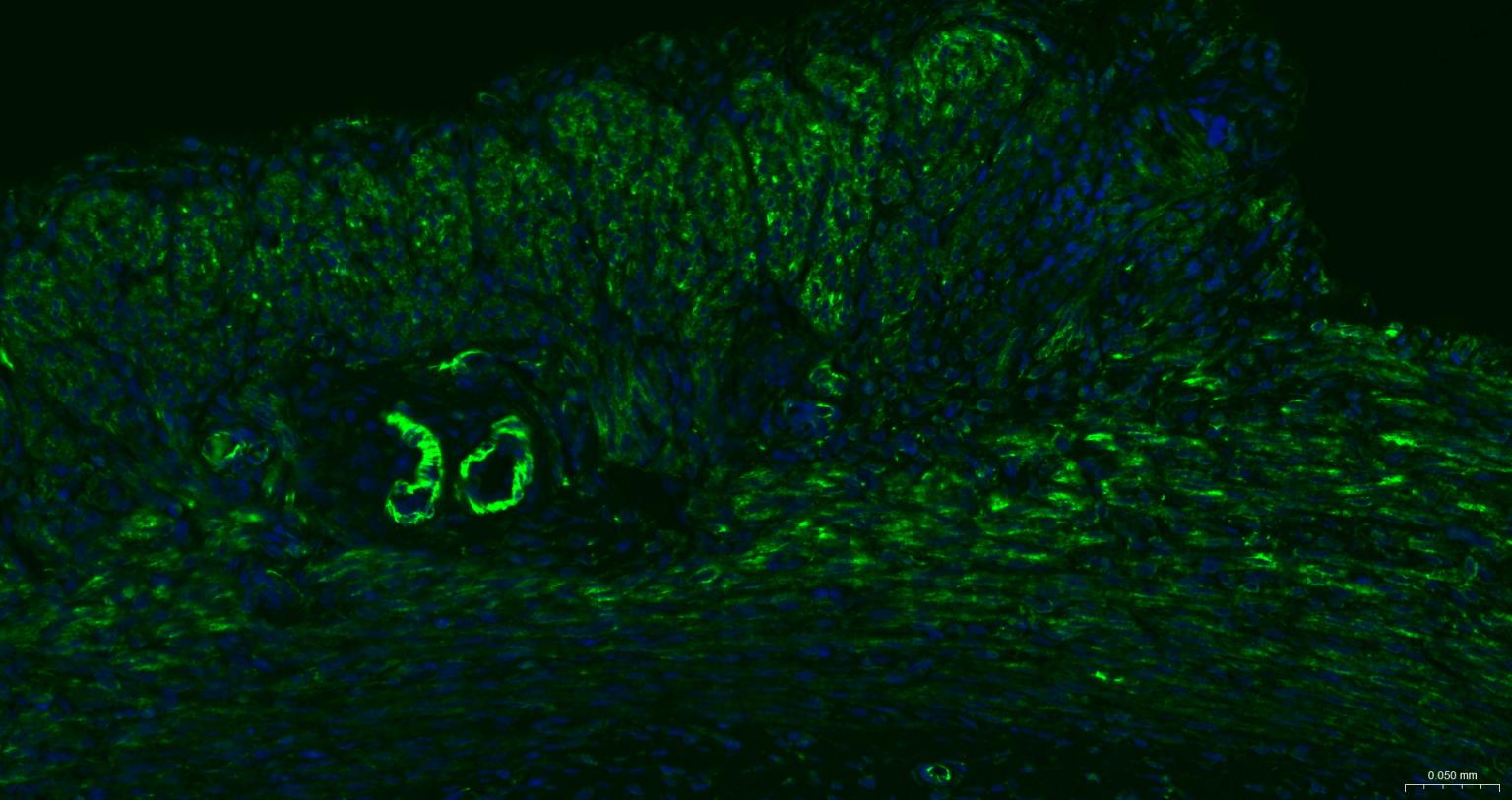 结蛋白重组兔单抗